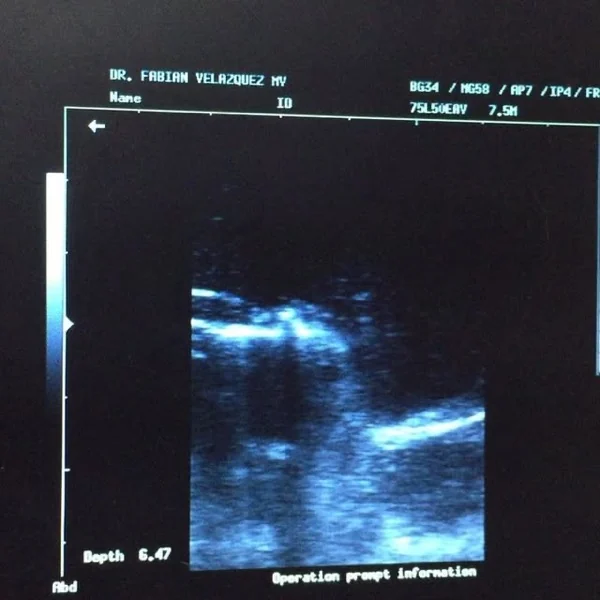 Pantalla de ultrasonido rotulada Dr. Fabián Velázquez MV durante un estudio